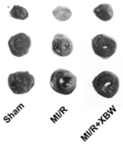 Medicine for resisting myocardial ischemia-reperfusion injury