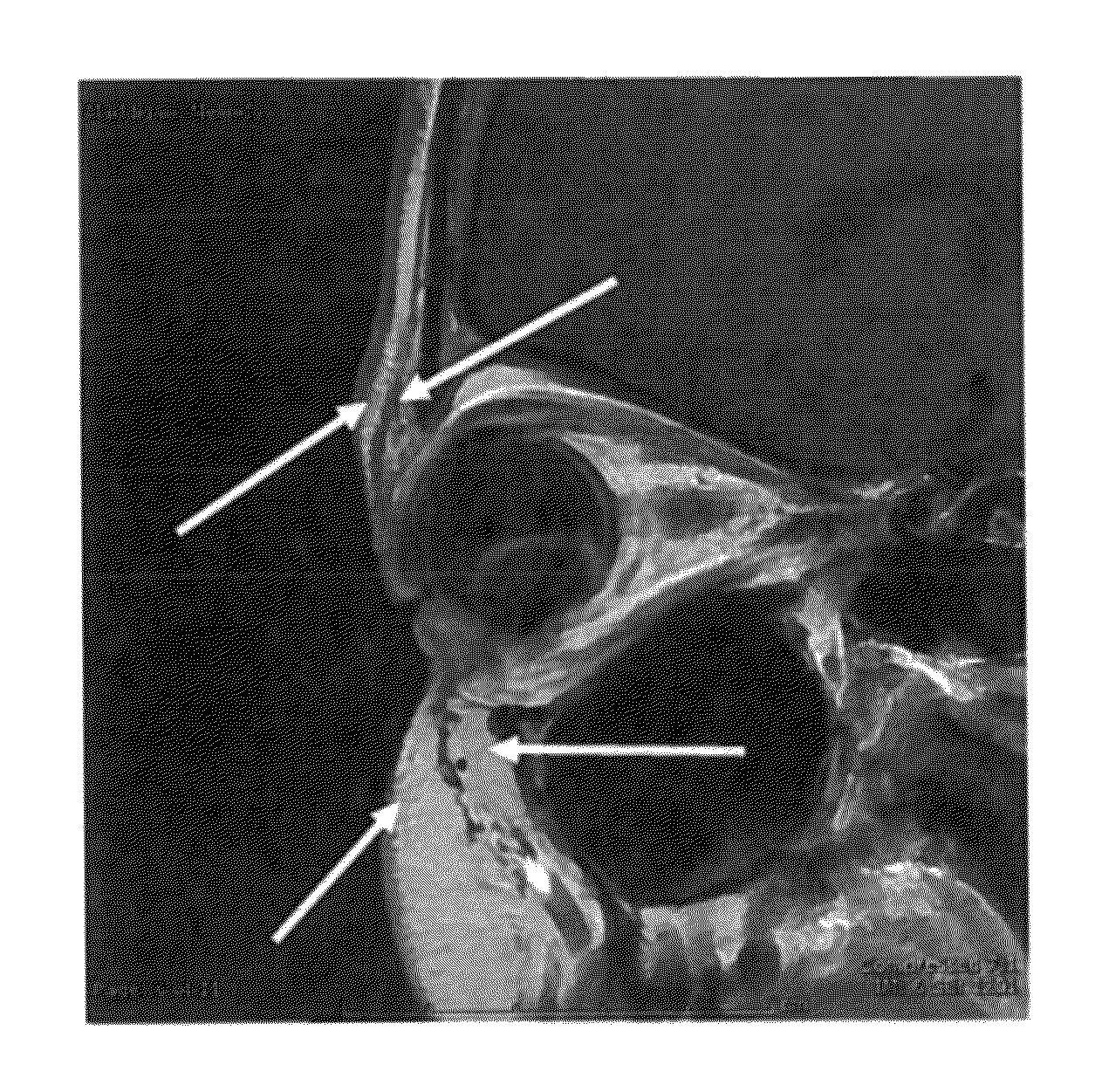 Extended length botulinum toxin formulation for human or mammalian use