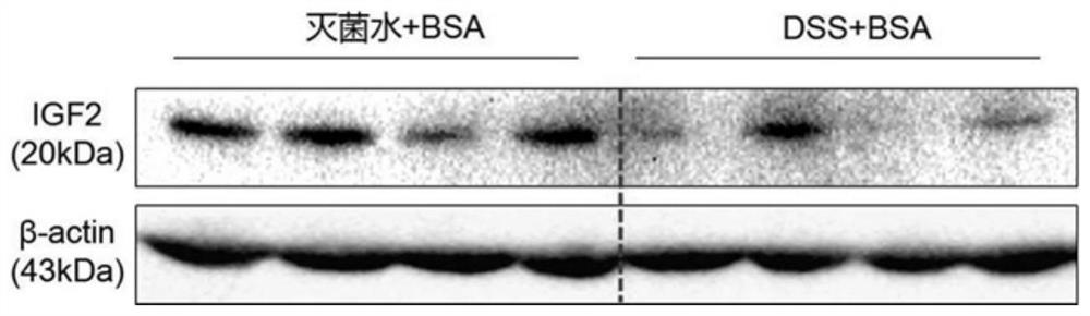 Application of insulin-like growth factor 2 recombinant protein in preparation of medicines for treating ulcerative colitis