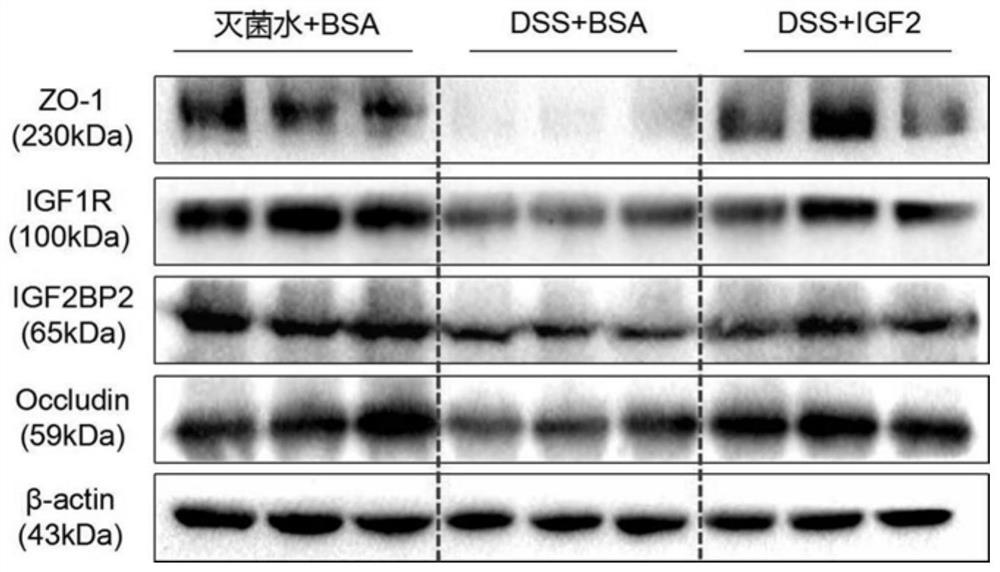 Application of insulin-like growth factor 2 recombinant protein in preparation of medicines for treating ulcerative colitis