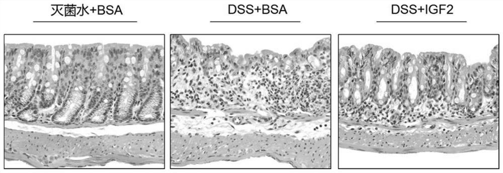 Application of insulin-like growth factor 2 recombinant protein in preparation of medicines for treating ulcerative colitis