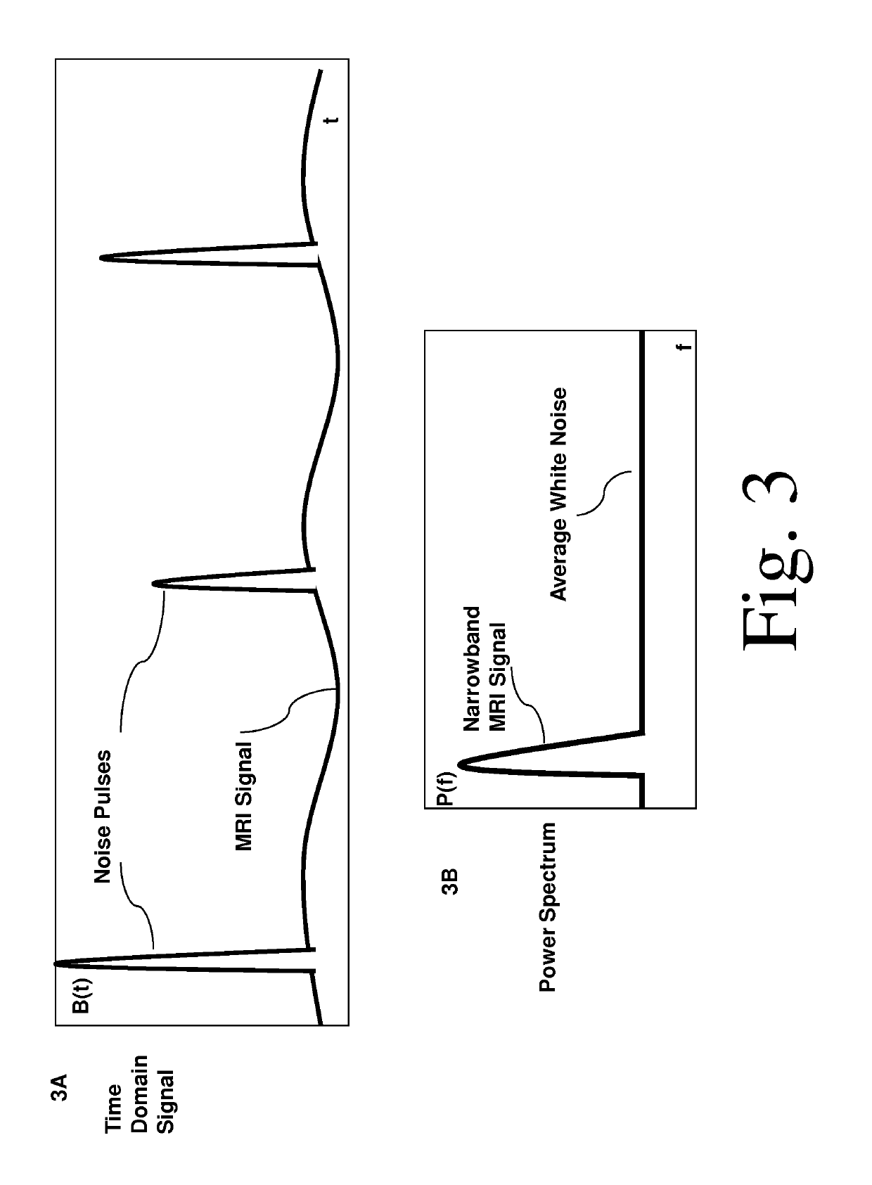 System and method for noise reduction in magnetic resonance imaging