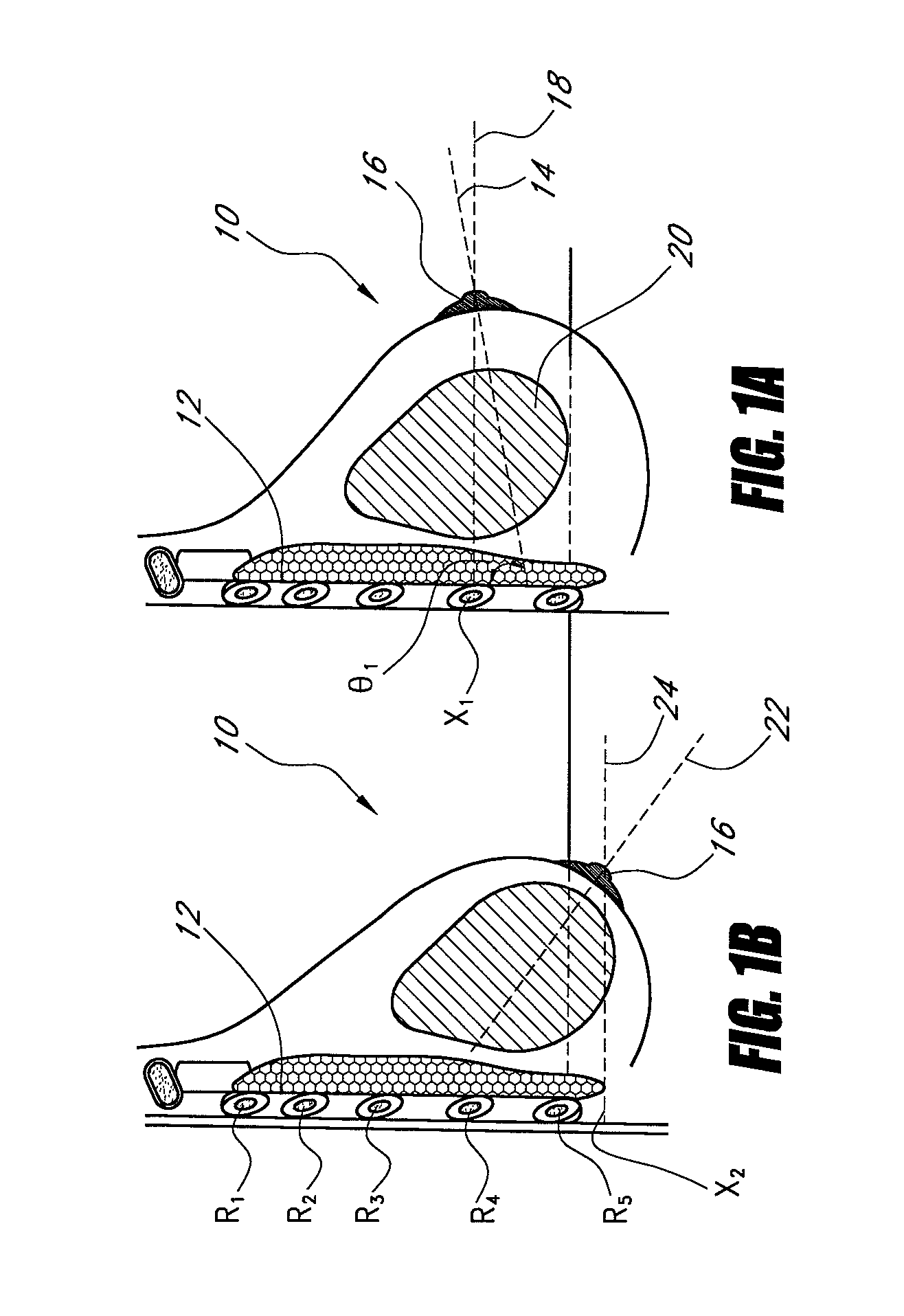 Nonaugmentive mastopexy