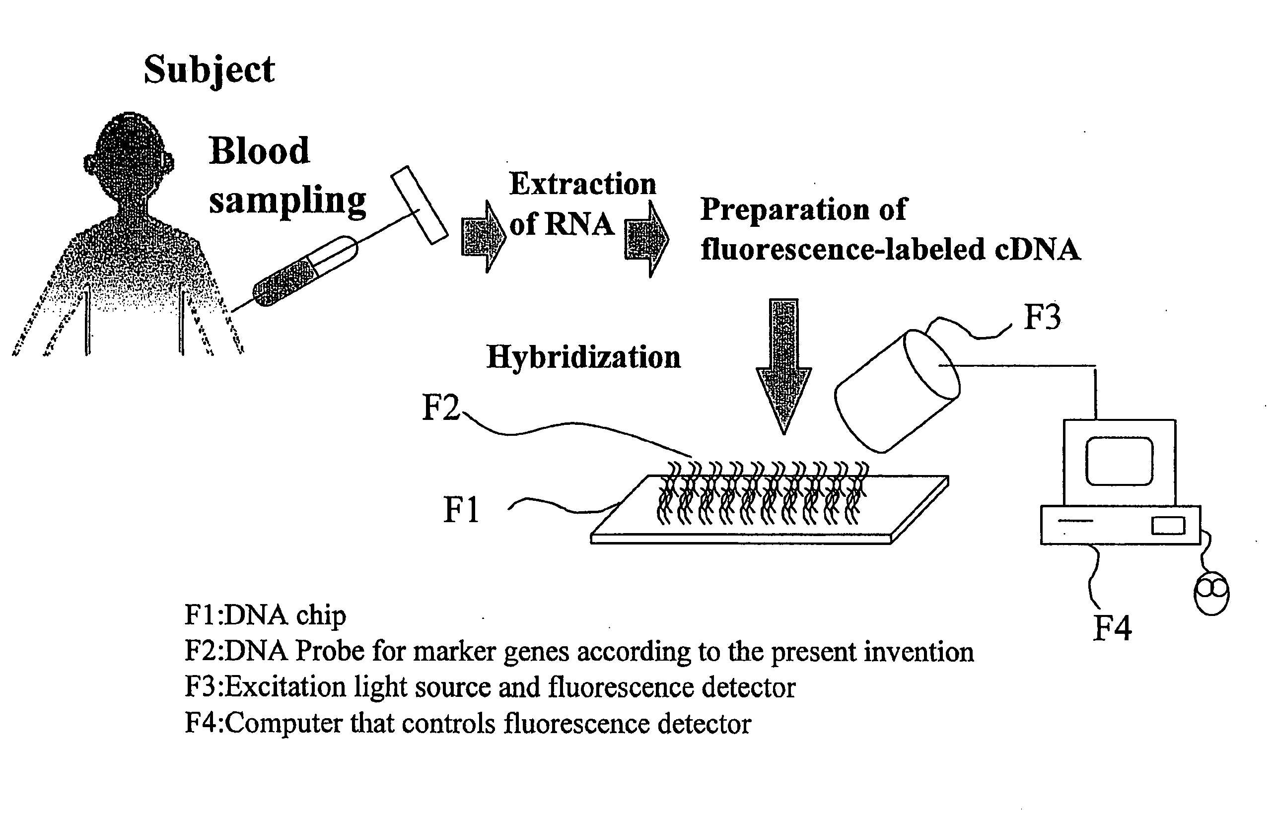 Method for Diagnosing Depression