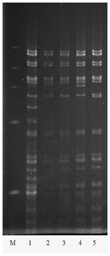 Duck Tembusu virus e protein truncated gene, recombinant duck plague virus and its construction method and application