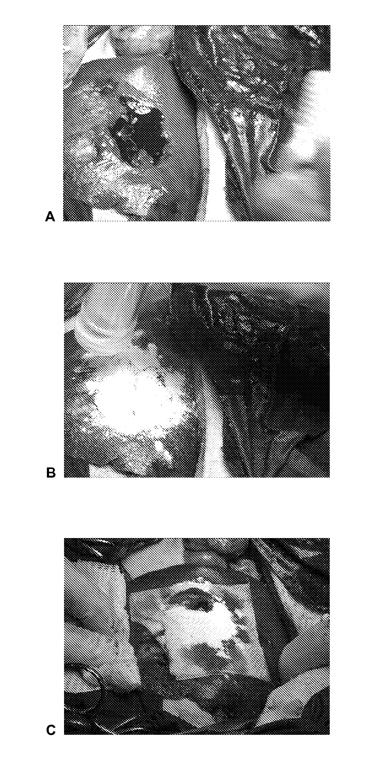 Dry powder fibrin sealant