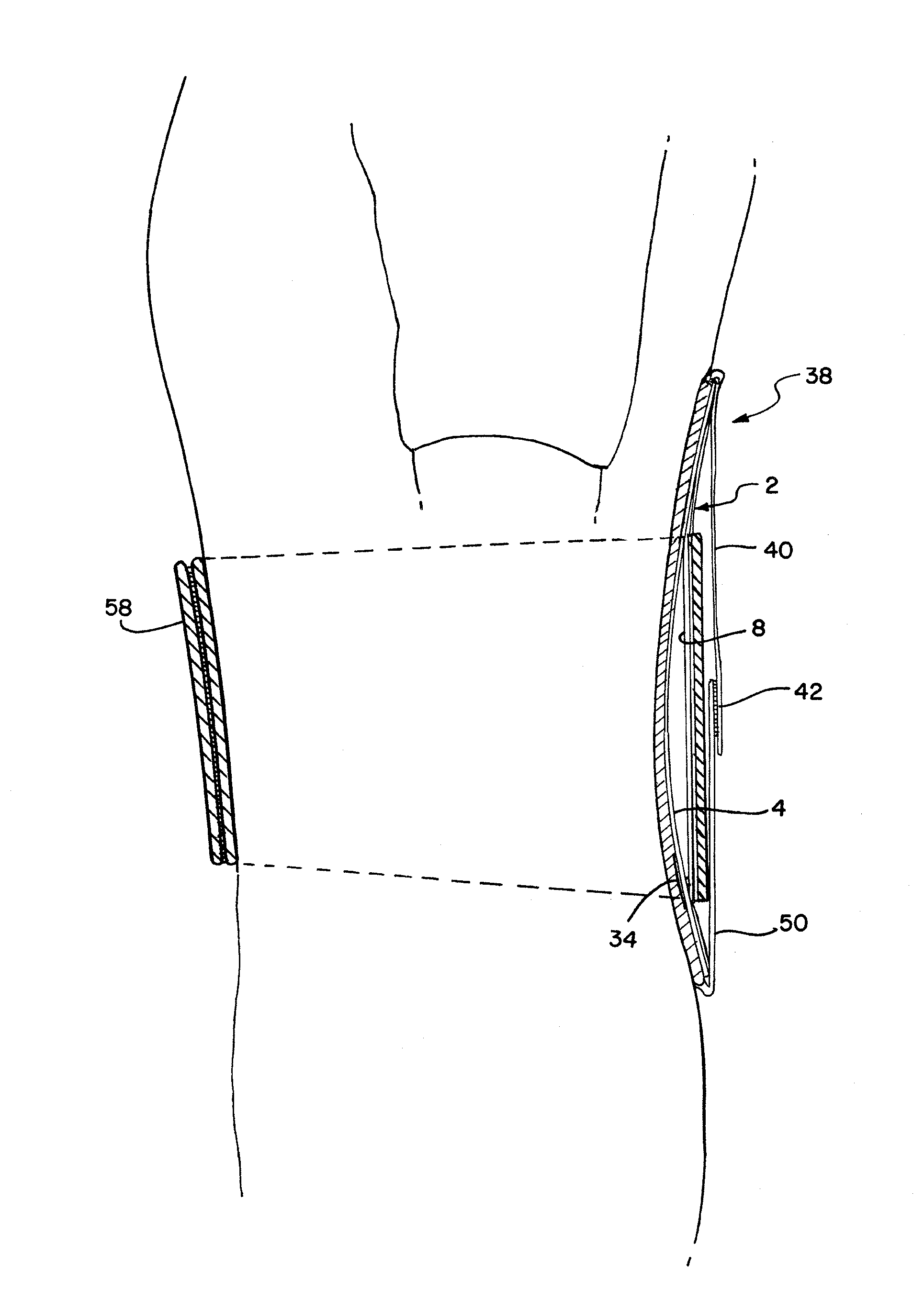 Adjustable lordosis orthopedic insert for a back brace