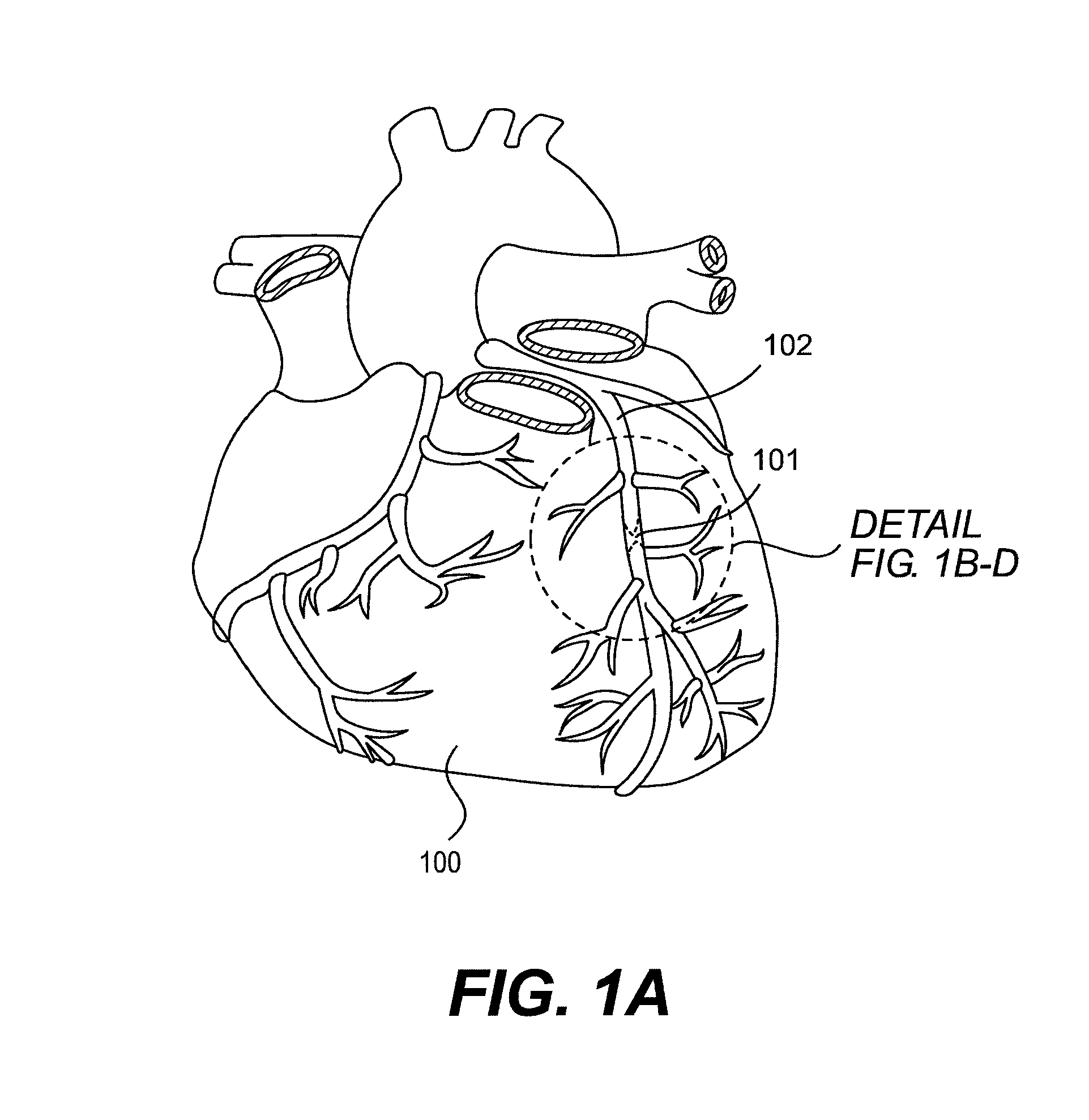 Endovascular devices and methods