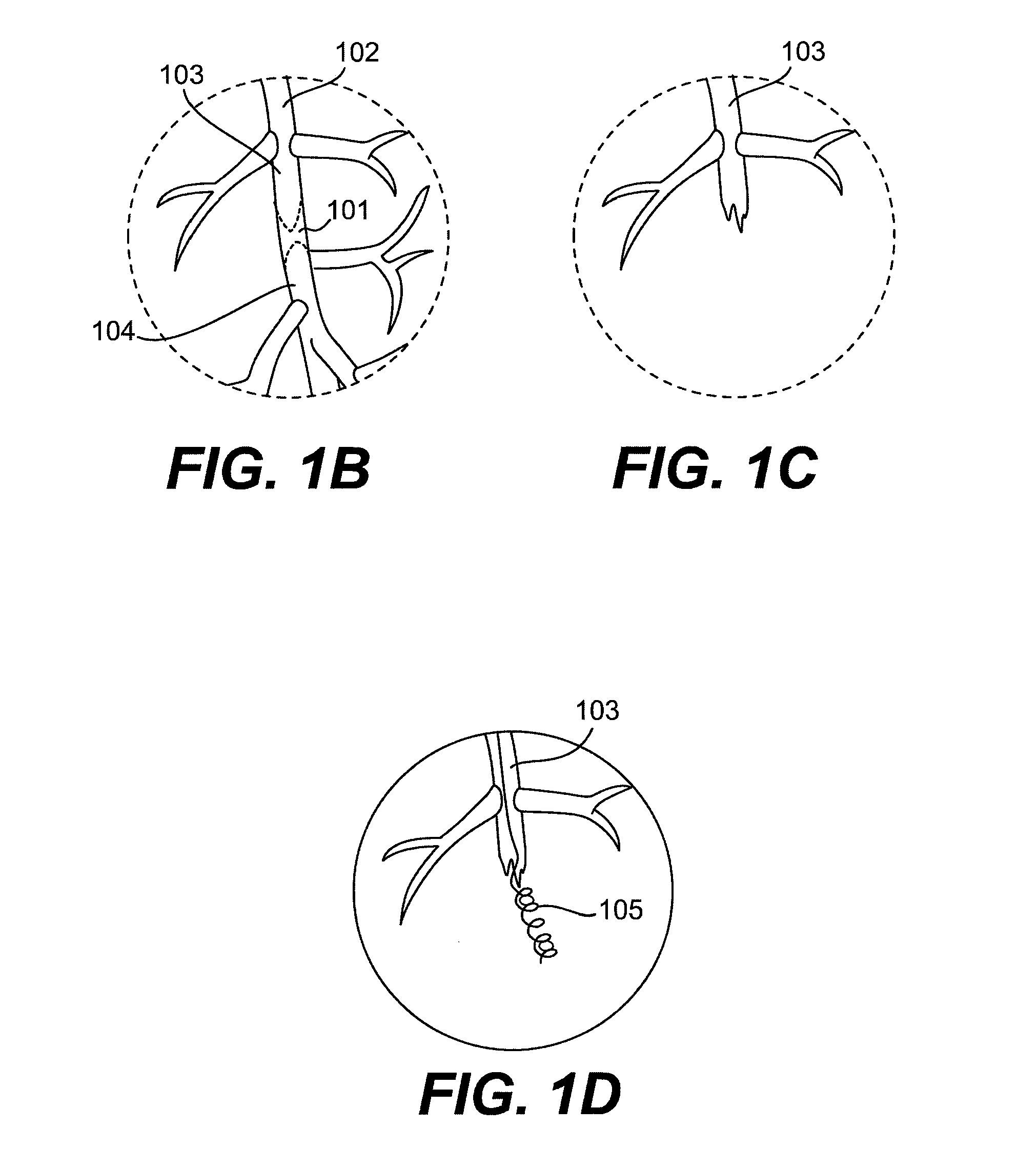 Endovascular devices and methods