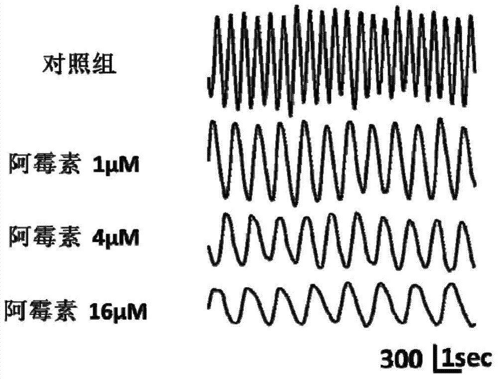 Drug cardiotoxicity detection analysis method based on myocardial cell sensor