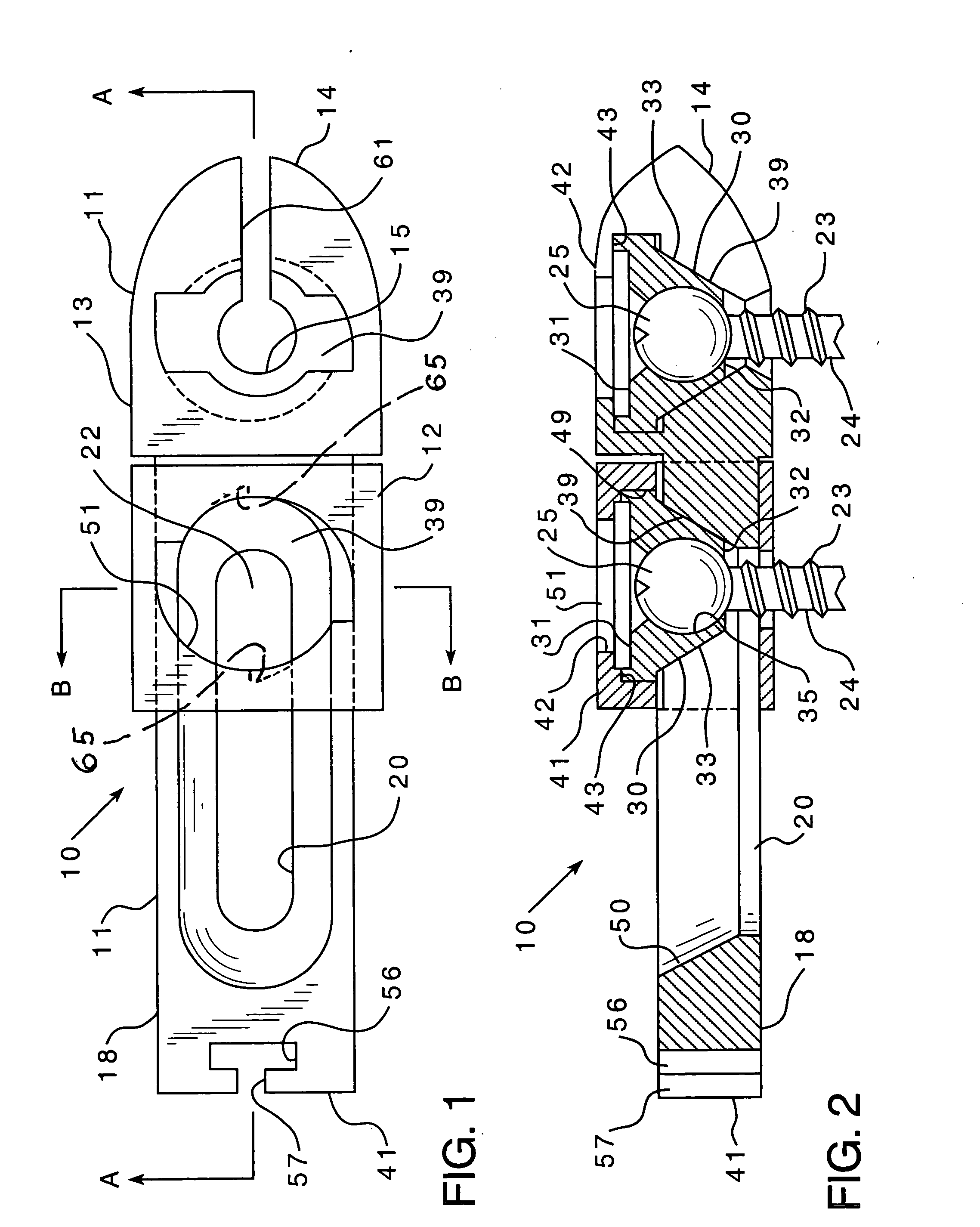 Bone fixation assembly and method of securement