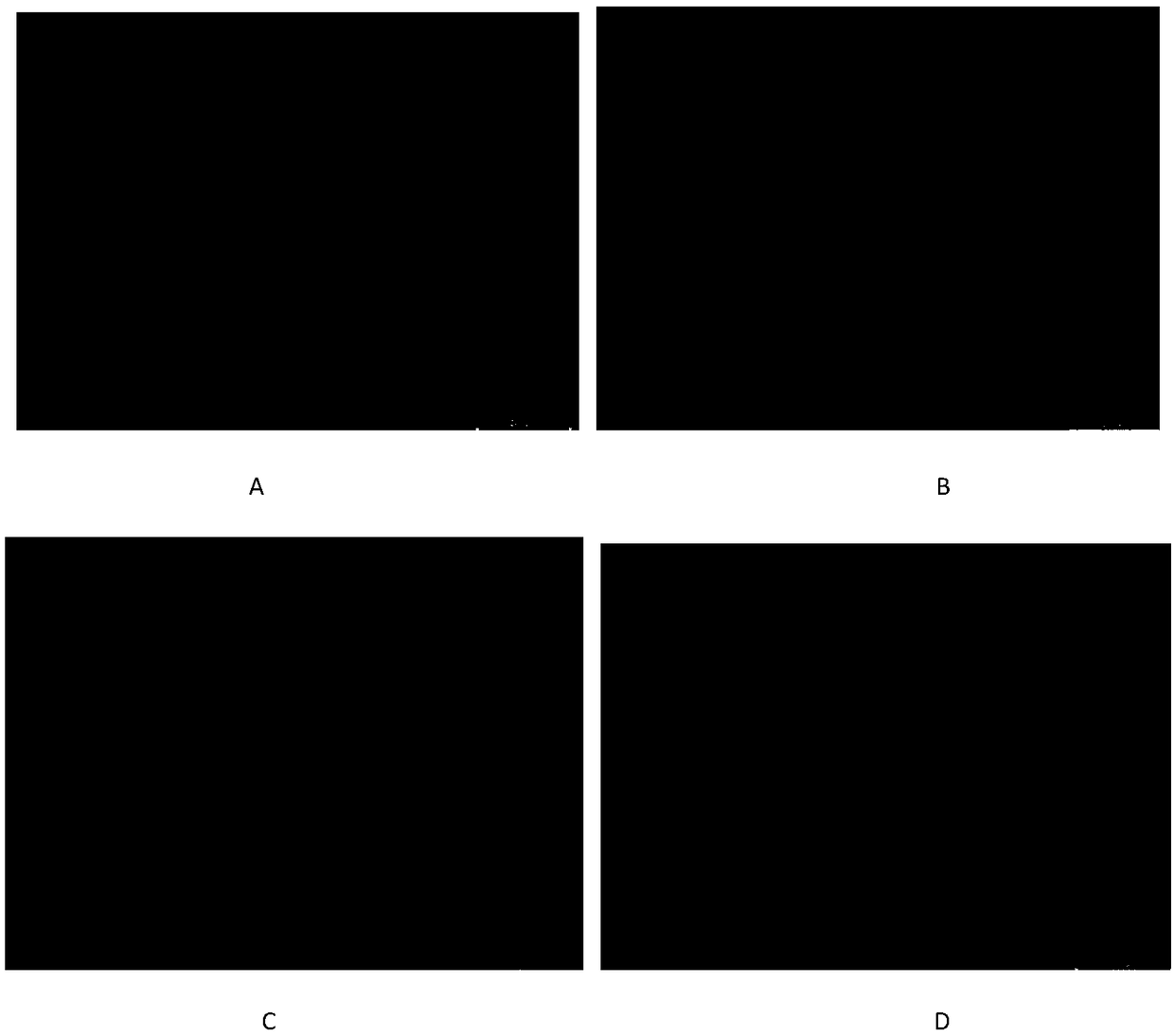 Medicament with functions of resisting oxidization and inhibiting hepatic tissue fibrosis and preparation method thereof