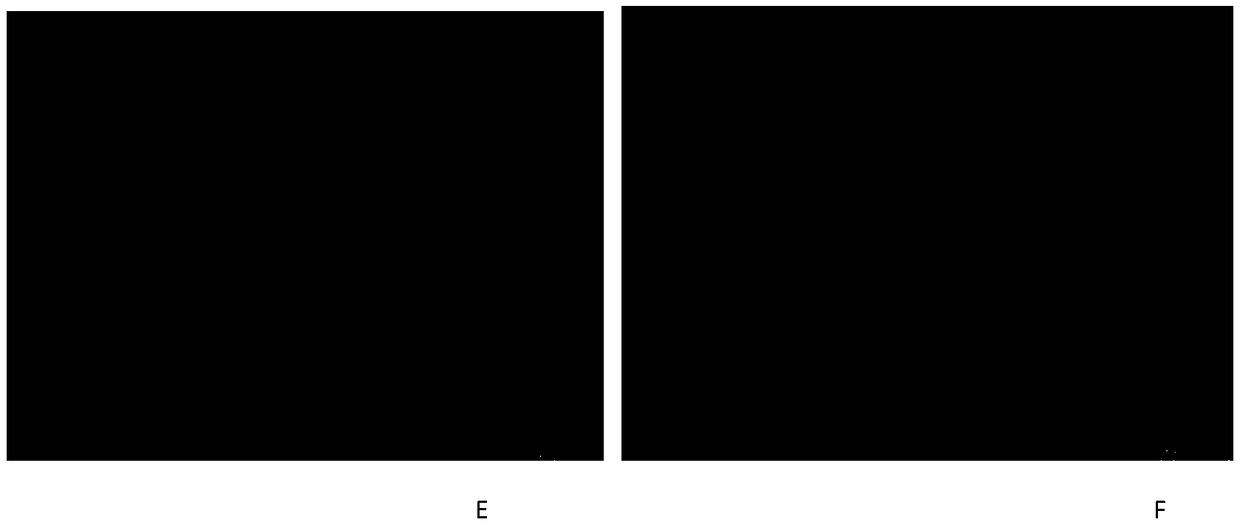 Medicament with functions of resisting oxidization and inhibiting hepatic tissue fibrosis and preparation method thereof