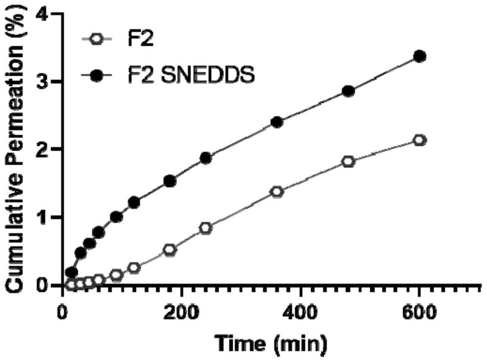 Cannabidiol self-nanoemulsion buccal membrane preparation as well as preparation method and application thereof