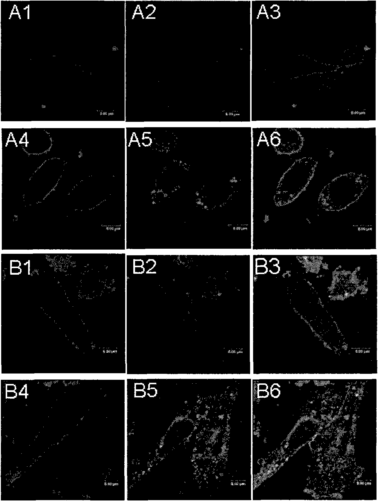 Composite of all-trans-retinoic acid and liposome and application thereof