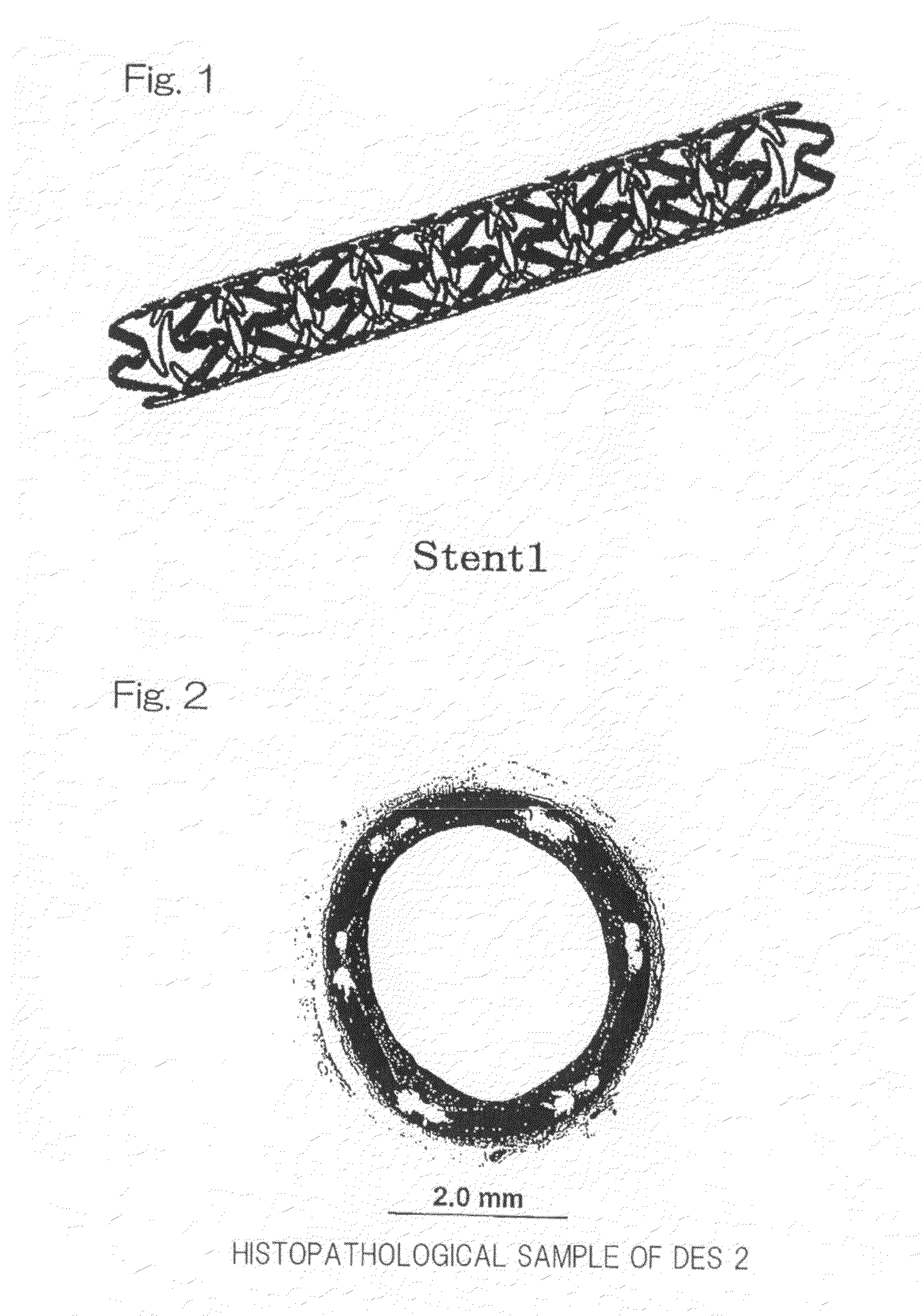 Sustained drug-releasing stent