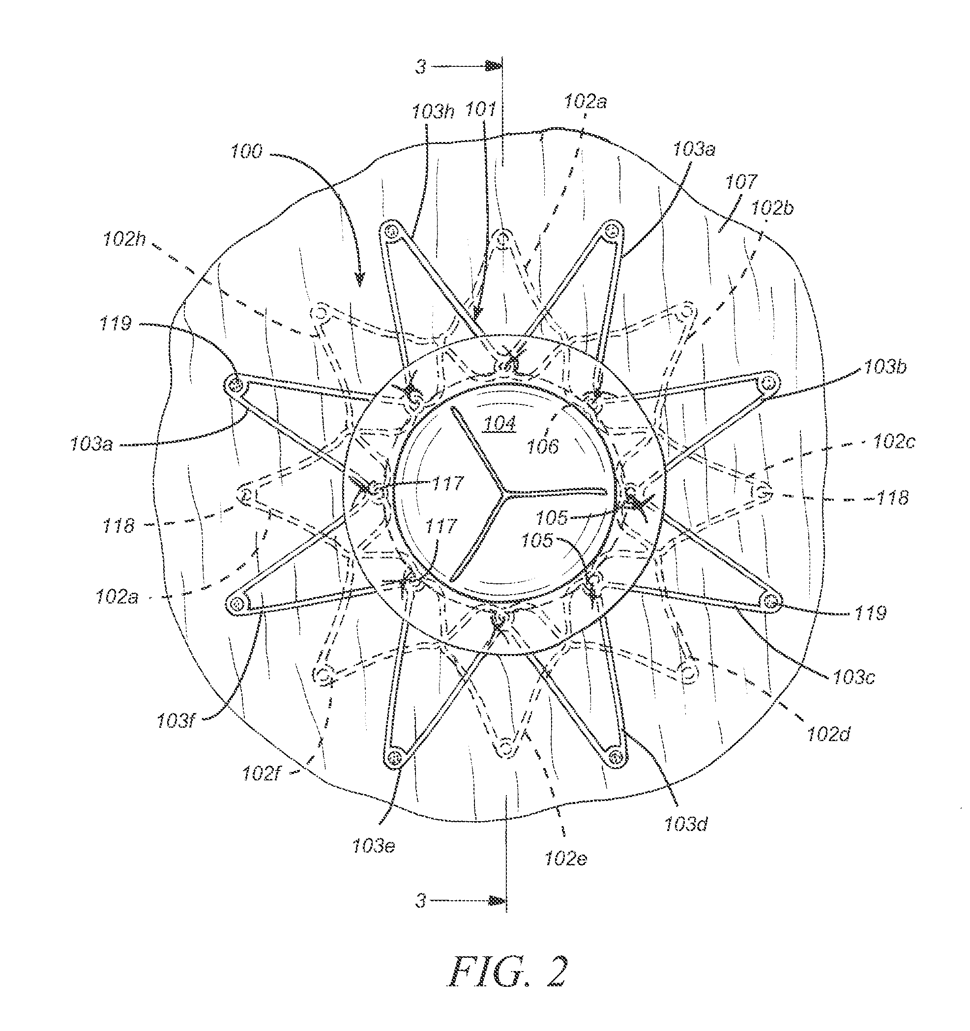 Mounting tool for loading a prosthesis