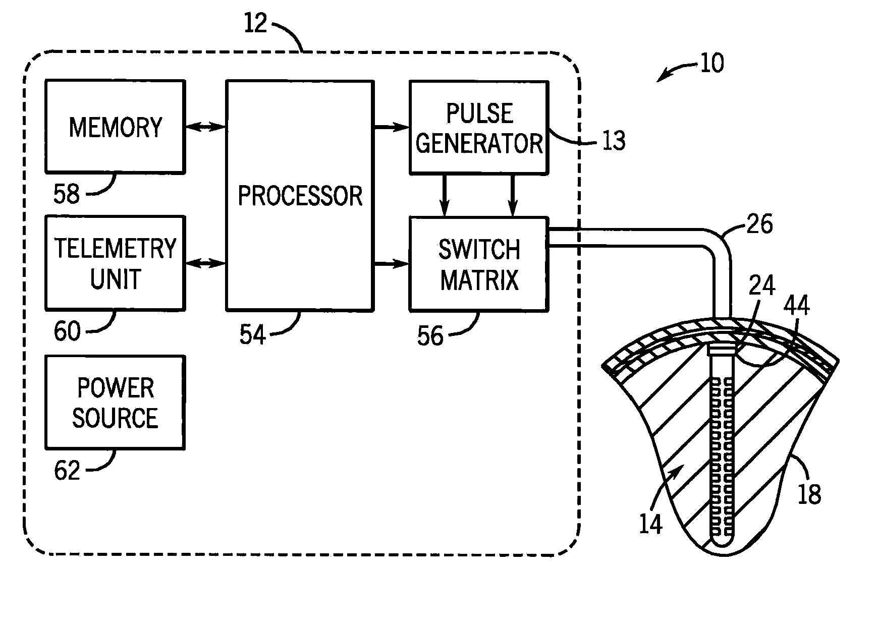 Deep brain stimulation implant with microcoil array