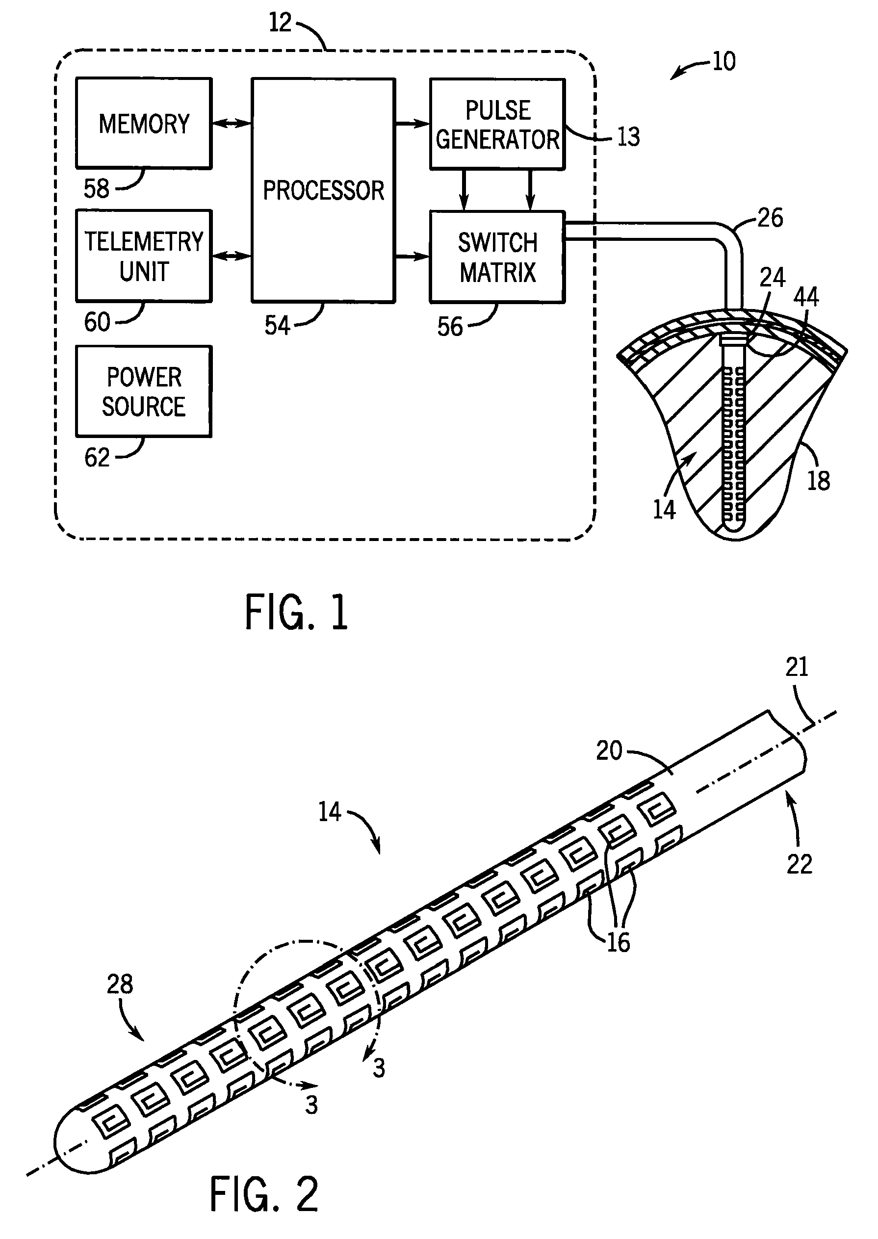 Deep brain stimulation implant with microcoil array