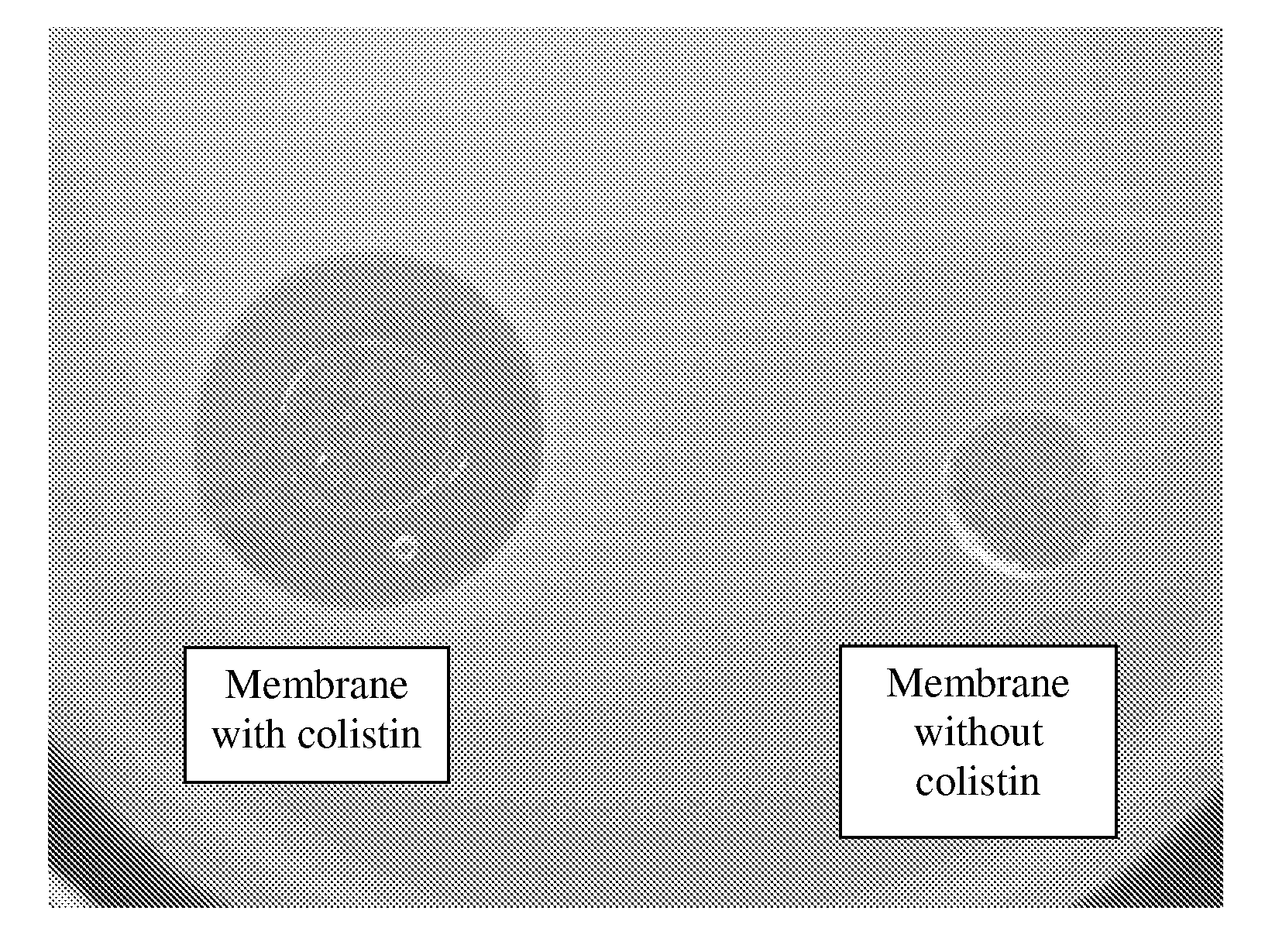 Antibiotic dressing for the treatment of infected wounds