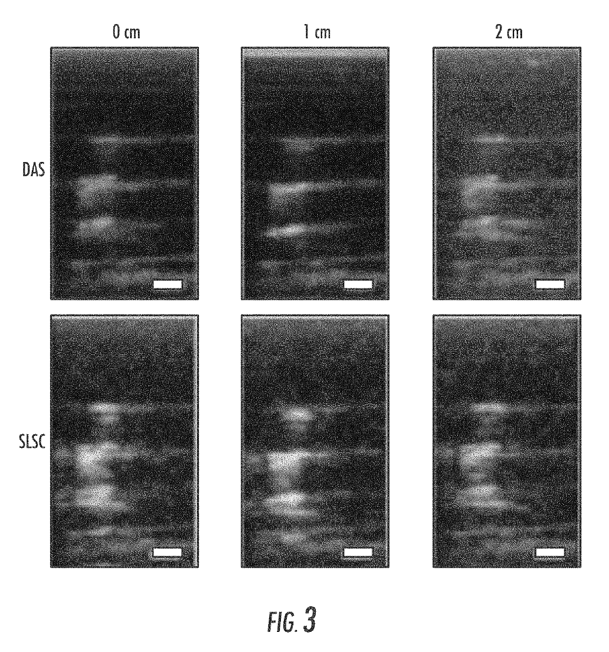 Method and system for transcranial photoacoustic imaging for guiding skull base surgeries