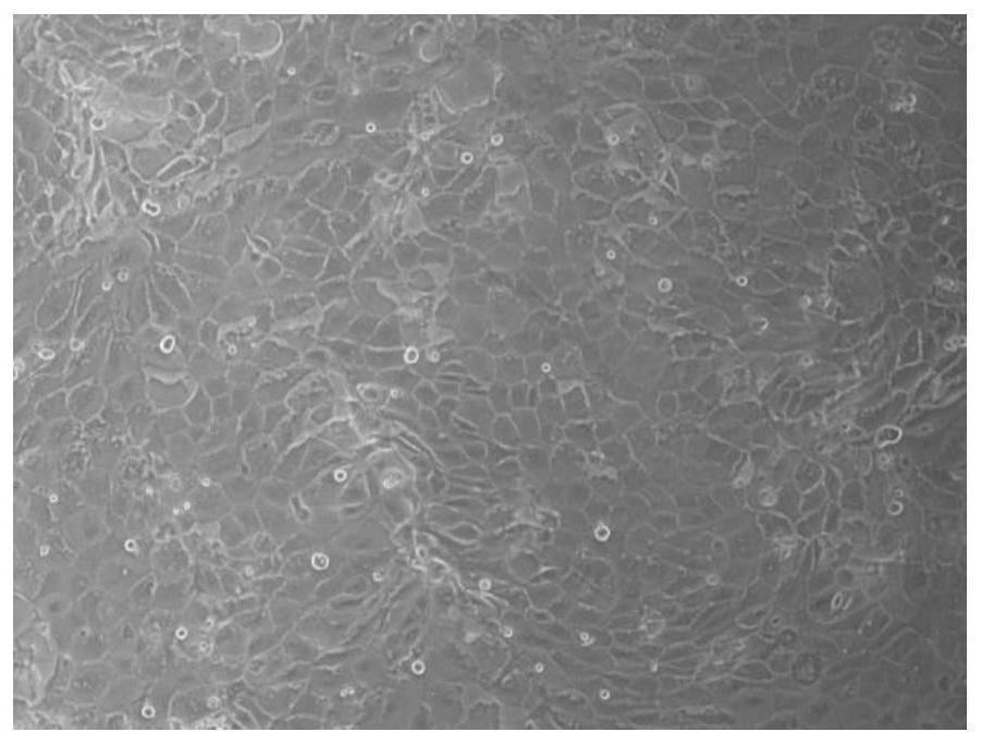 A method for establishing a sheep endometrial epithelial cell line and its application