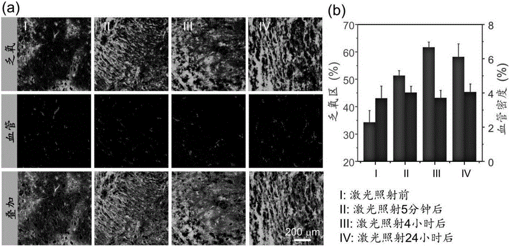 Hypoxia responsive liposome preparation, preparation method and application thereof