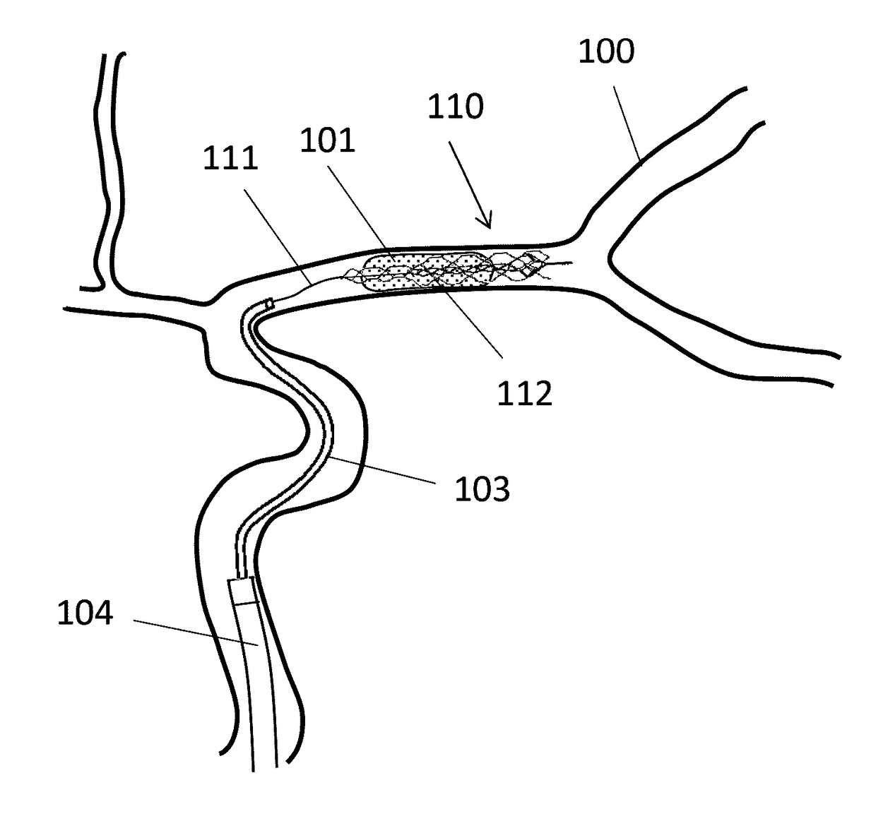 Clot retrieval device for removing clot from a blood vessel