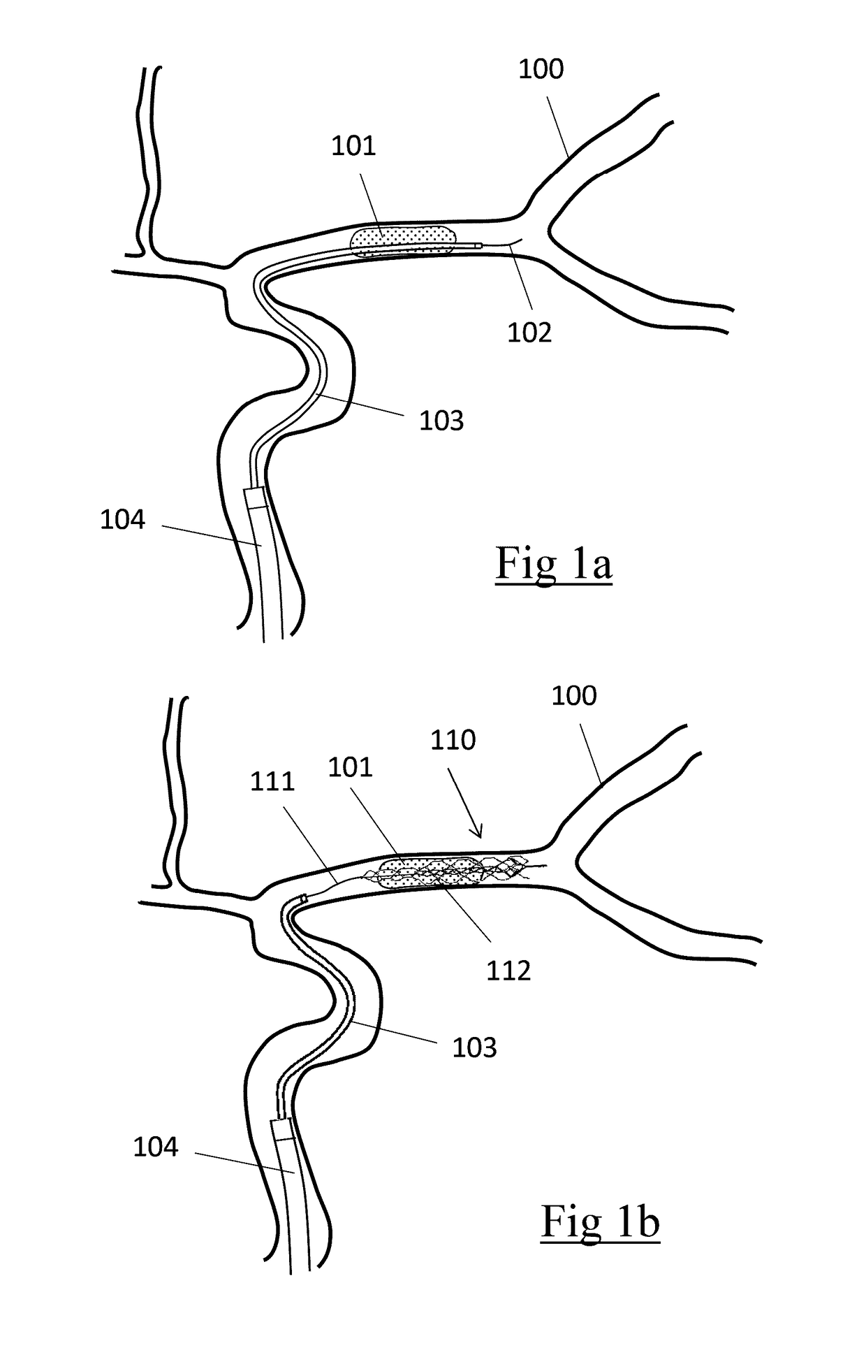 Clot retrieval device for removing clot from a blood vessel