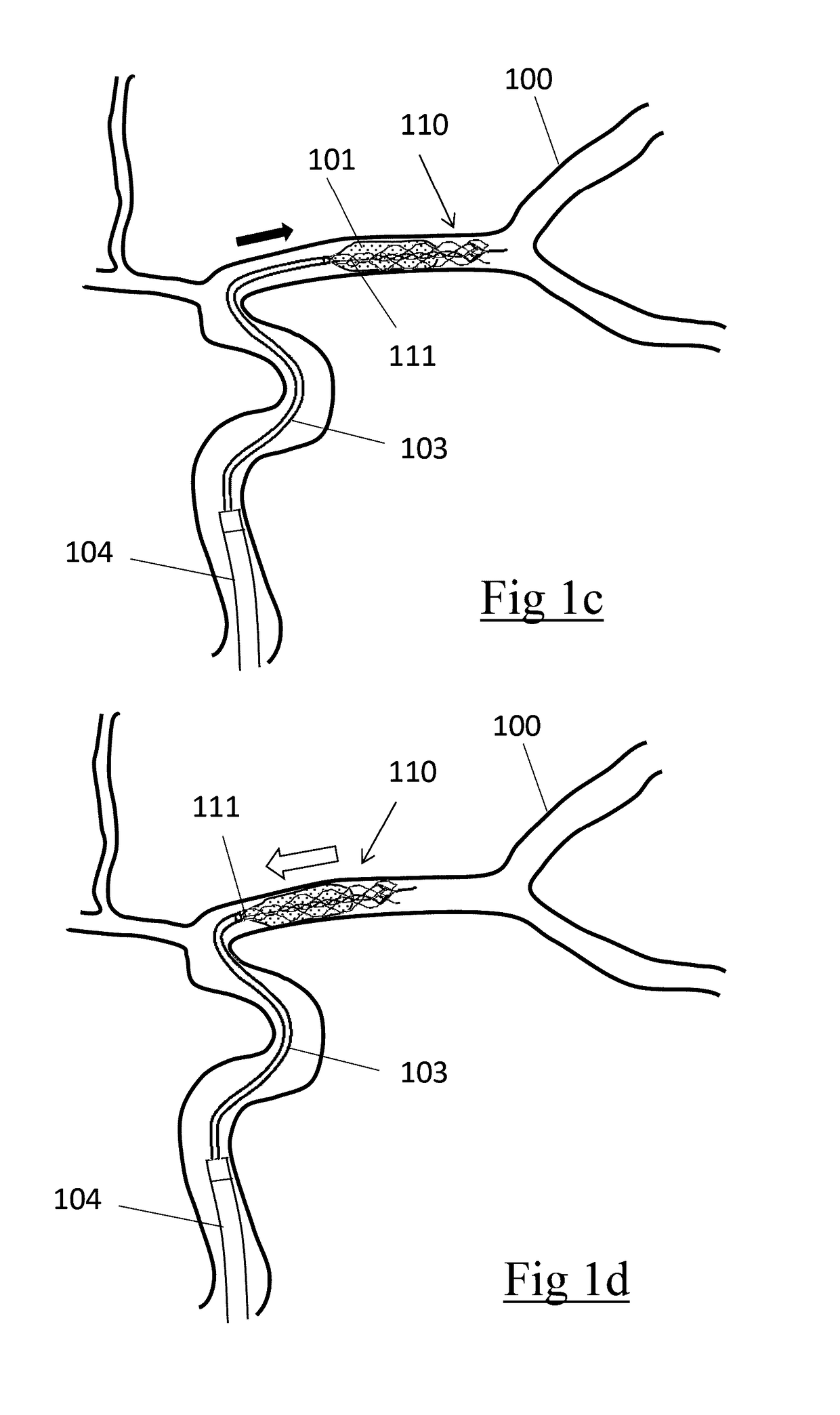 Clot retrieval device for removing clot from a blood vessel