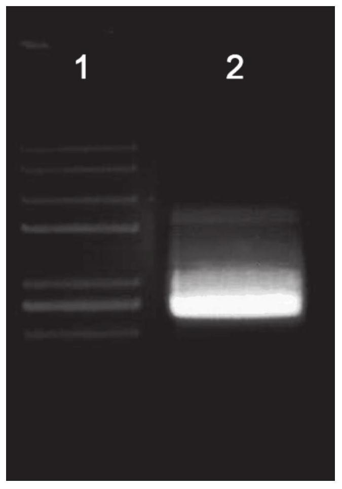 Grain development related protein TaGSR1 and application thereof in wheat plant type breeding