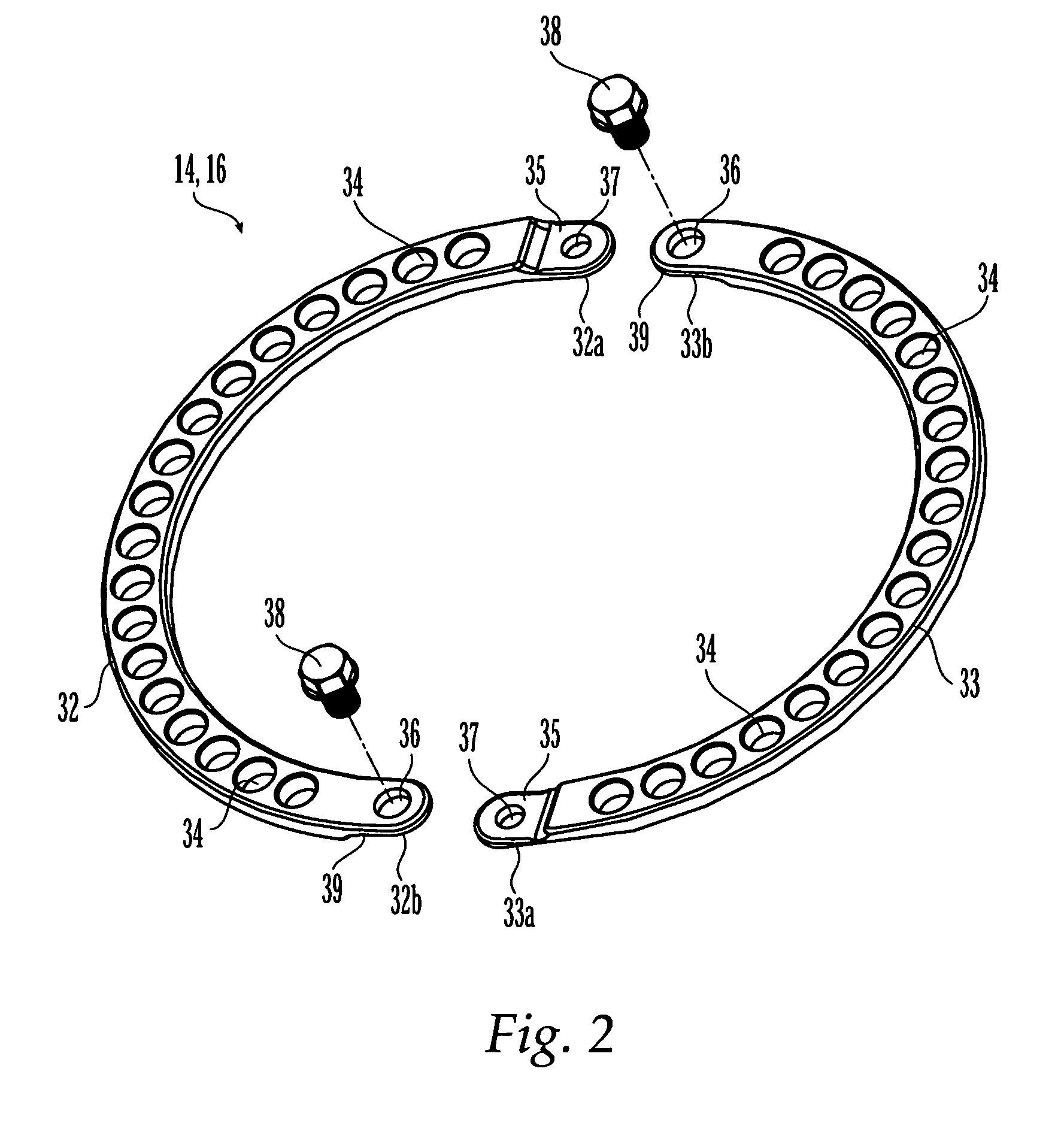 External fixation system and method of use