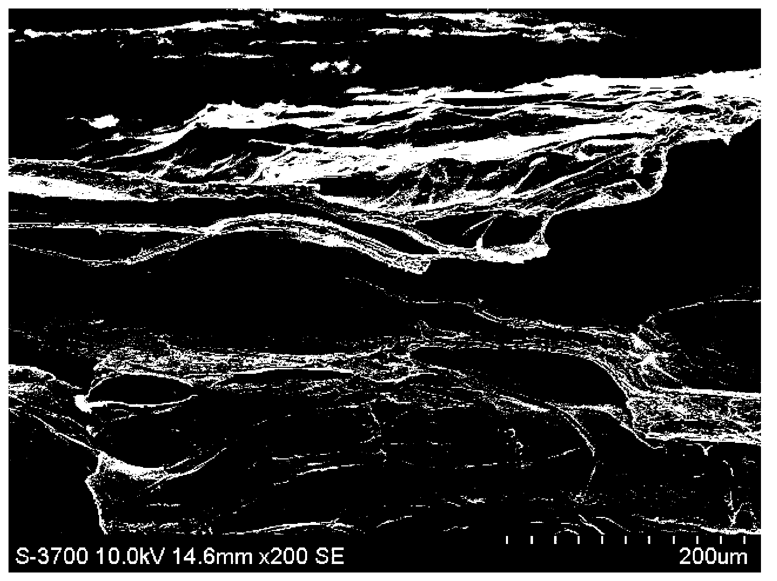 Preparation method of collagen matrix composite biological film for guided tissue regeneration