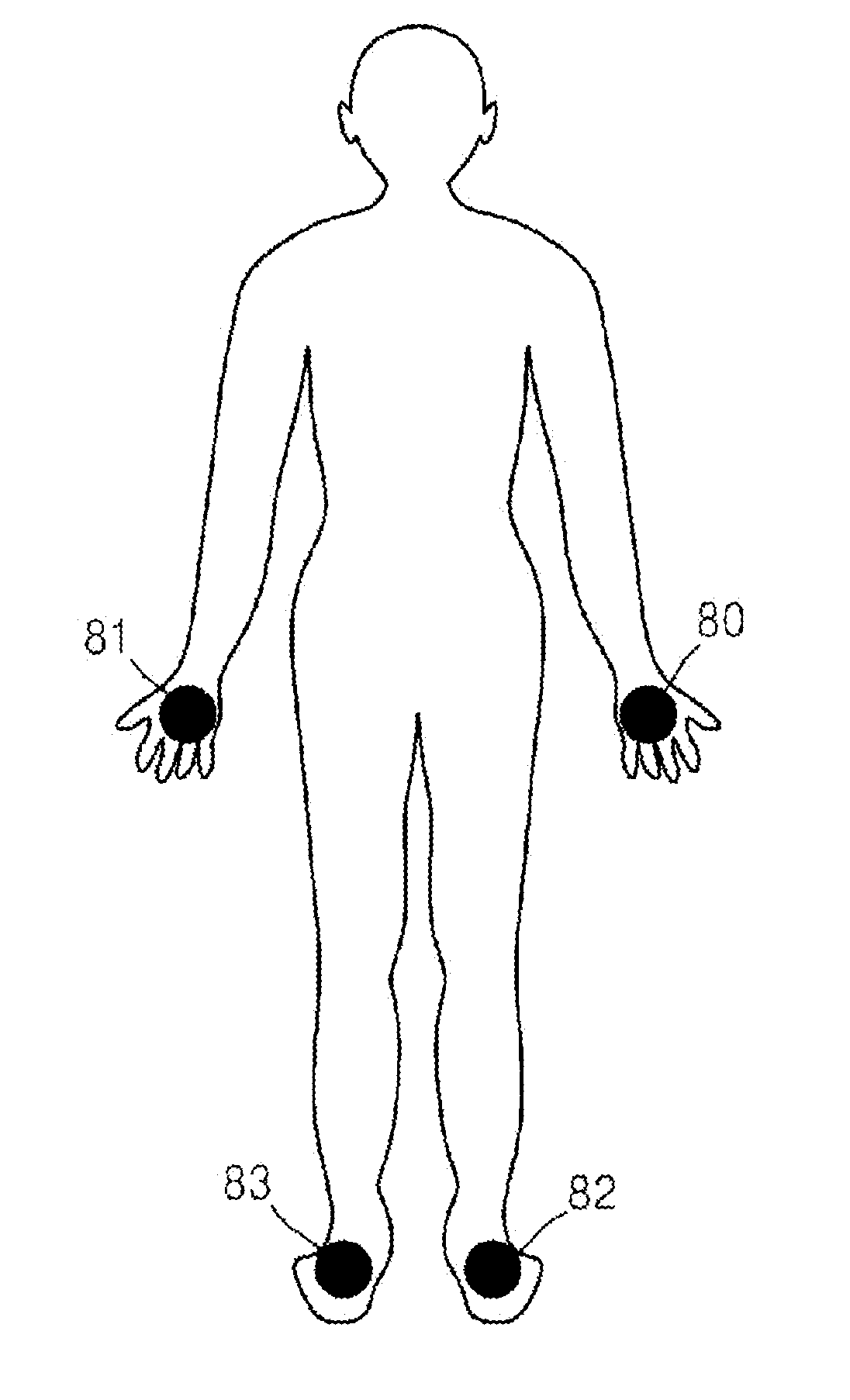 Low frequency stimulator using music and diet system including low frequency stimulator