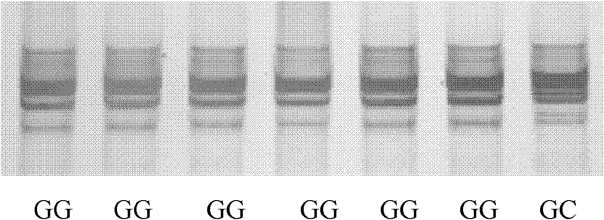 Method for detecting ox FTO (Fat Mass and Obesity-associated) gene single nucleotide polymorphism (SNP)