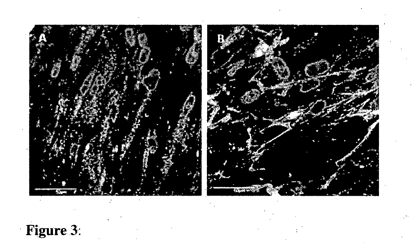 In Vivo Synthesis of Elastic Fiber