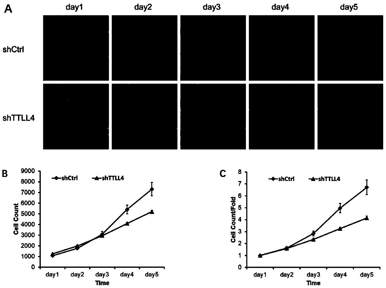 Application of human TTLL4 gene and related products