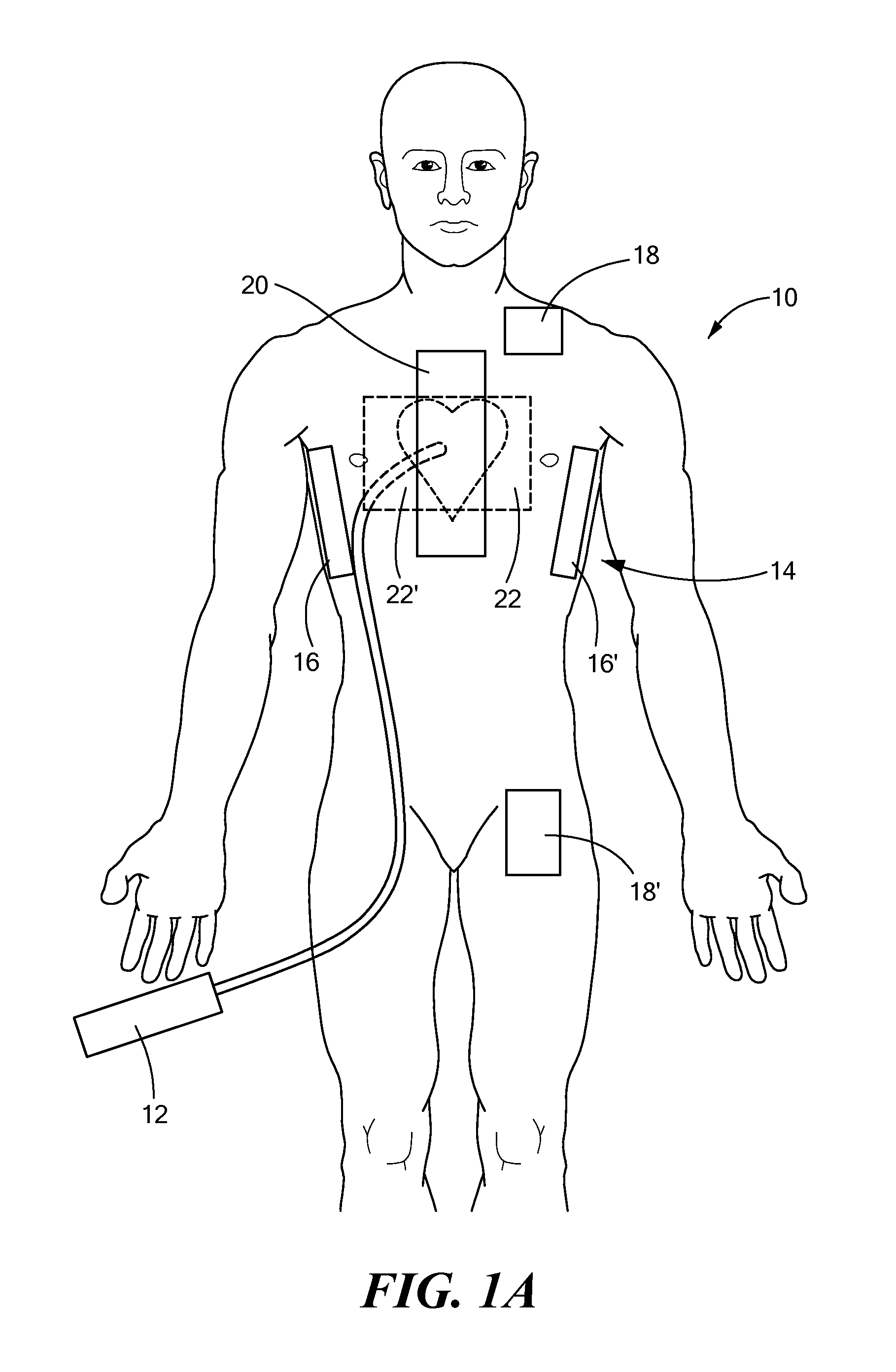 Systems and methods of performing medical procedures