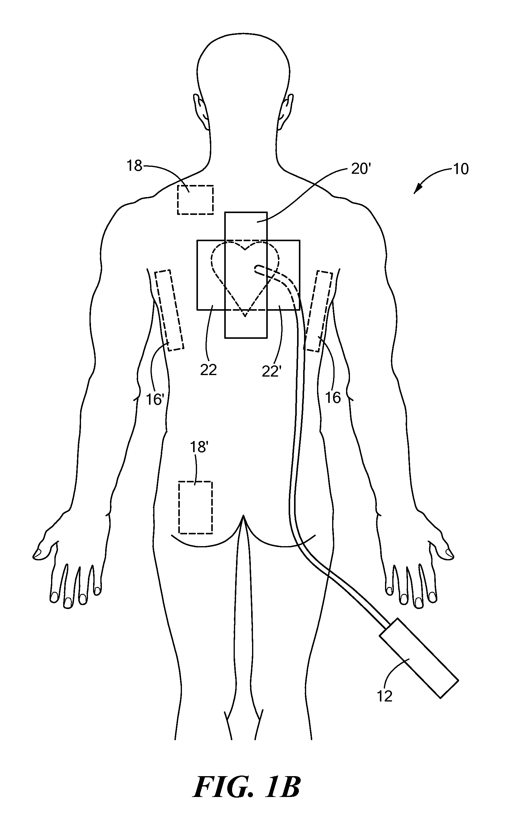 Systems and methods of performing medical procedures