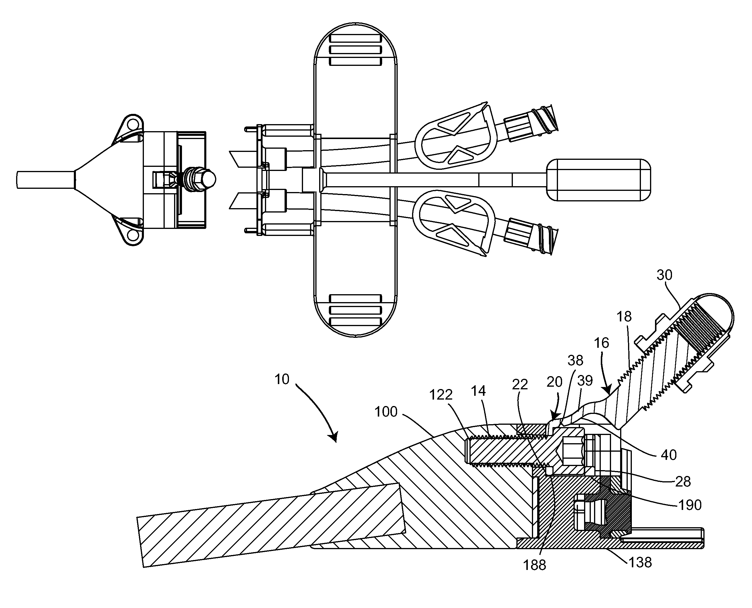 Extensionless reversible connection catheter apparatus