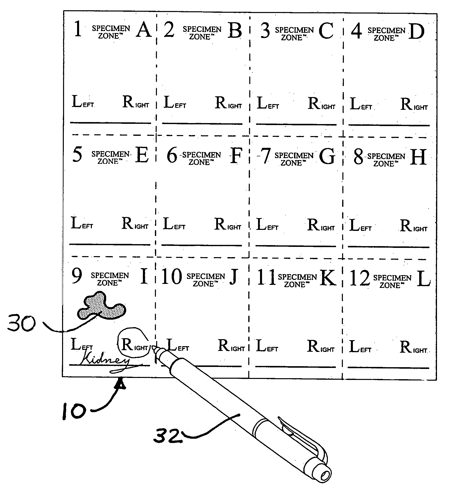 Specimen labeling system