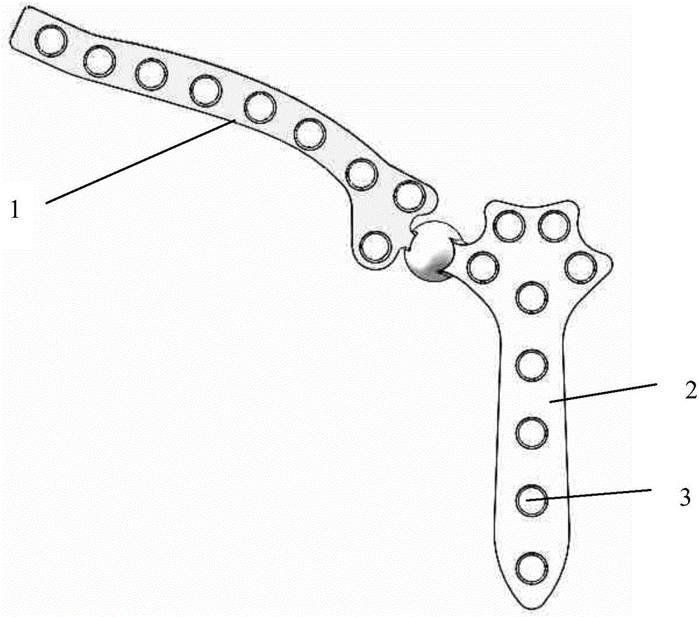 Hinge type bone fracture plate used for dislocation of sternoclavicular joint