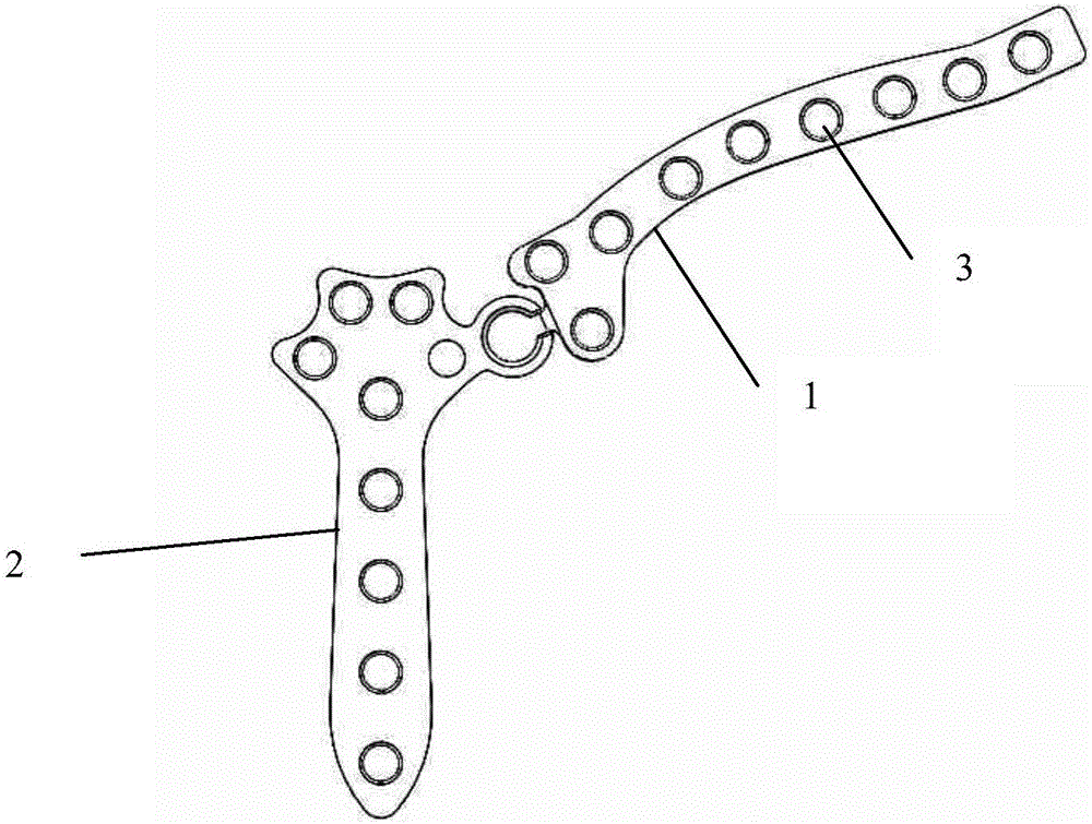 Hinge type bone fracture plate used for dislocation of sternoclavicular joint