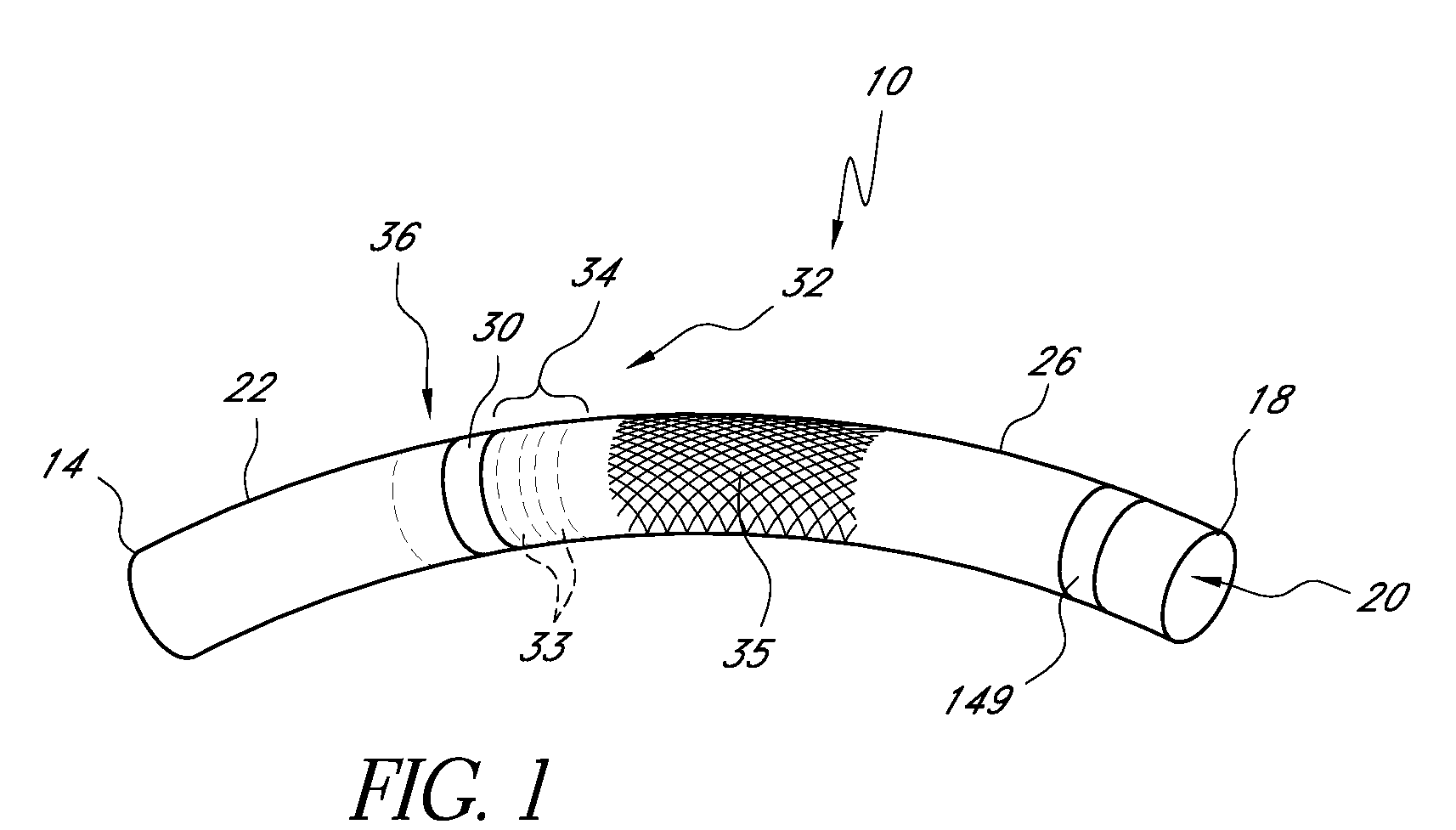 Vascular access system