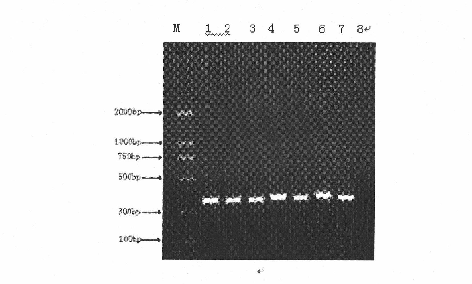 Rapid detection method of blood pathogenic bacteria based on CE-SSCP (Capillary Electrophoresis-Single Strand Conformation Polymorphism)