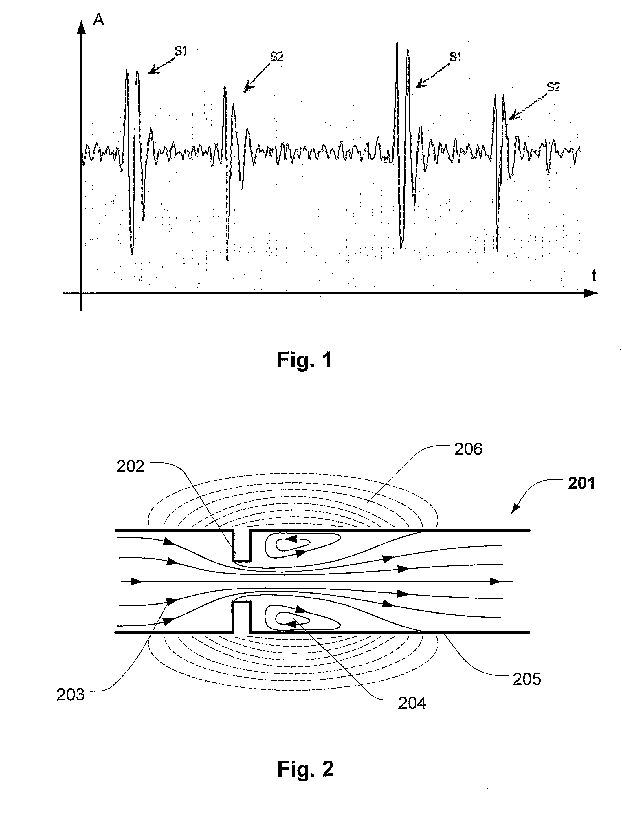 Multi parametric classification of cardiovascular sounds