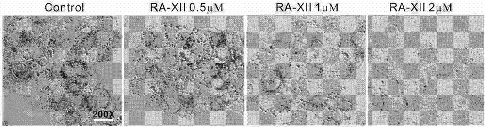 Inhibitor for tumor cell abnormal lipid metabolism by using plant cyclopeptides as effective component and application thereof