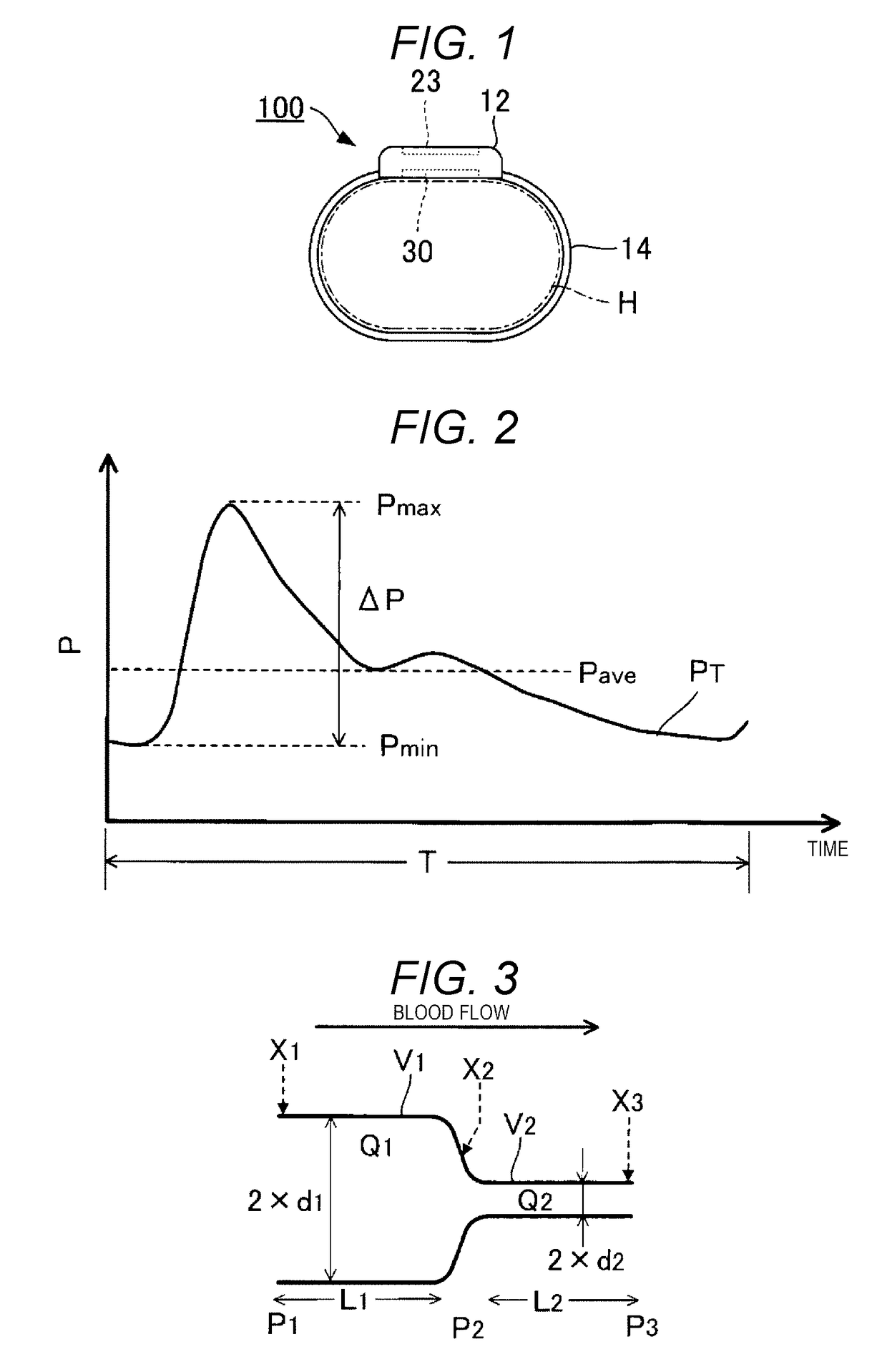 Biological analysis device, biological analysis method, and program