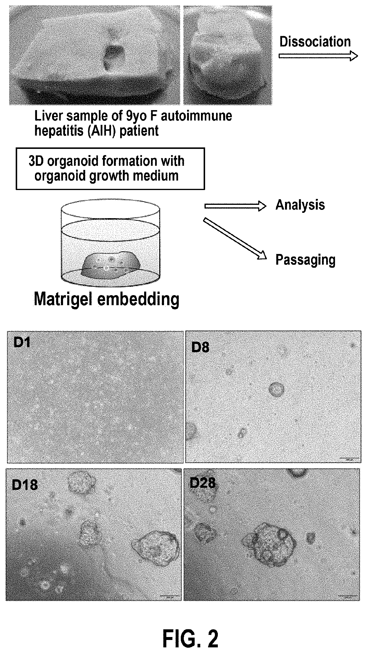 Liver support system comprising liver organoids and methods of making and using same