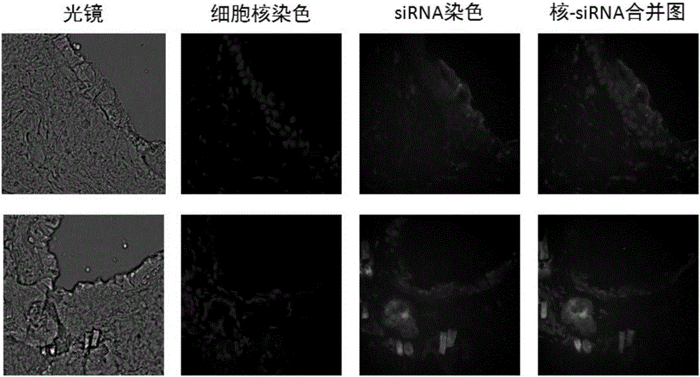 Transdermal peptide and application thereof